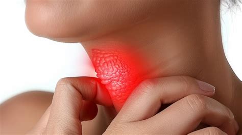 Premium Photo | Woman with sore throat tonsil lesion showing symptoms of acute respiratory viral ...