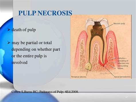 Pulpal & periradicular diseases & their diagnosis