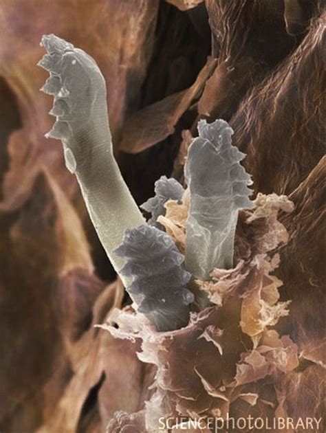 The bad news: Dead mites are spilling their junk onto your face. But this new discovery may lead ...