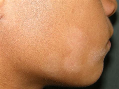 Small White Spots On Skin Cream | edu.svet.gob.gt