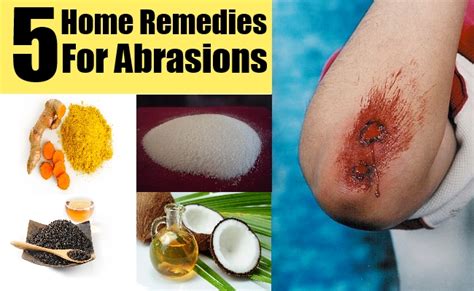 5 Home Remedies For Abrasions – Natural Home Remedies & Supplements