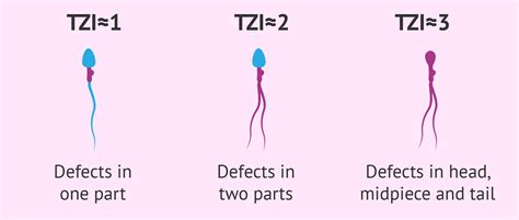 Teratozoospermia index (TZI)