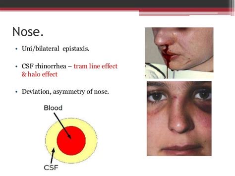 Clinical Evaluation in Maxillofacial Trauma