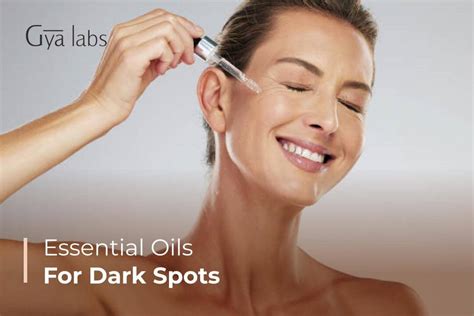 Top Essential Oils for Hyperpigmentation and Dark Spots