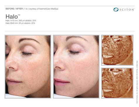 The Many Faces of Sciton® Laser Skin Treatments | Aya Medical Spa