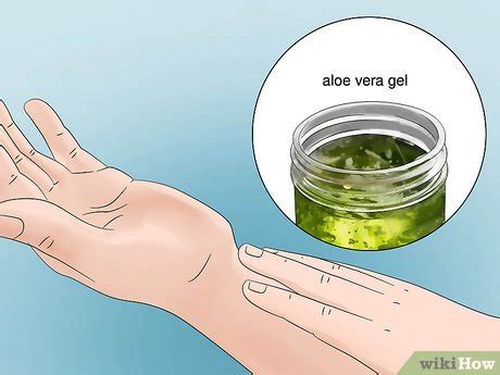 3 Ways to Treat Flea Bites - wikiHow