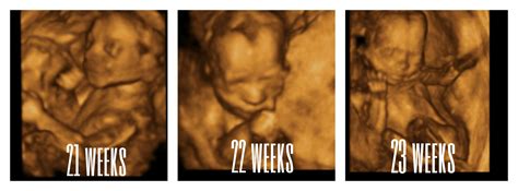 3D 4D- Ultrasound Pictures- Youngstown, Boardman Ohio