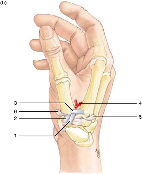 Figure 2.10 from Trapeziometacarpal Joint Arthritis | Semantic Scholar