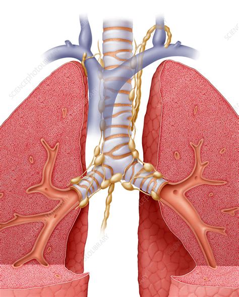 Lung Lymph Nodes - Stock Image - C001/5026 - Science Photo Library