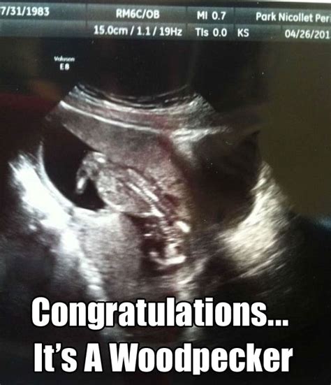 The 20 Funniest Ultrasound Pictures Ever