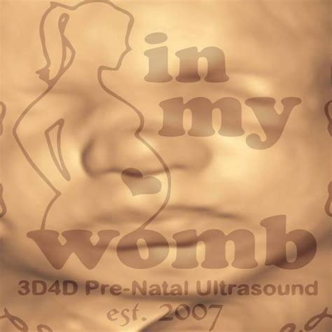 In My Womb 3D4D Ultrasound Centre | Mandaluyong