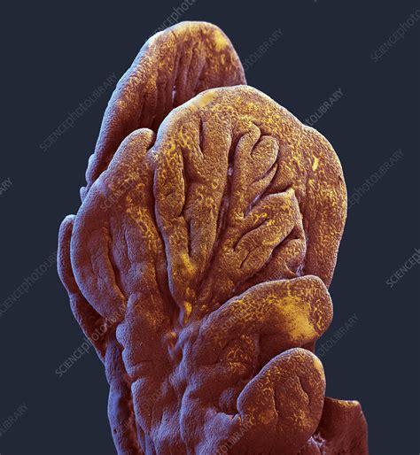 Fimbriae of a fallopian tube, SEM - Stock Image - C049/1583 - Science ...