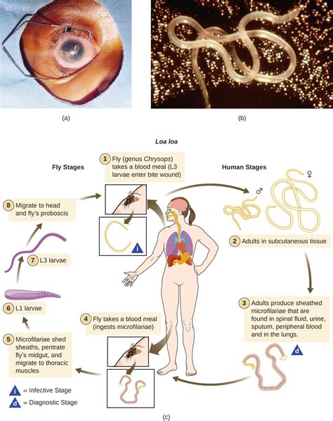 21.5: Protozoan and Helminthic Infections of the Eyes - Biology LibreTexts