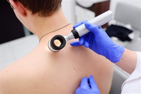 What You Need To Know About Preventing Melanoma - Skin Wellness Center