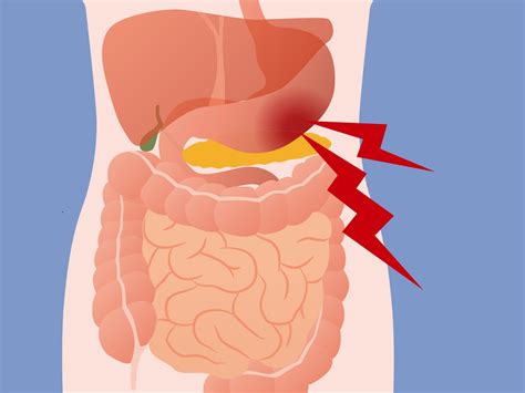 Large Colon Pain Left Side | Bruin Blog