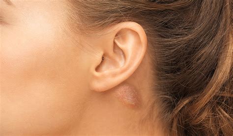 What You Need To Know About That Lump Behind Your Ear