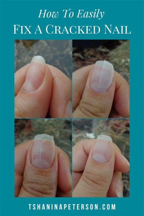 7 Easy Steps to Fix A Cracked Nail At Home - Tshanina Peterson in 2021 ...