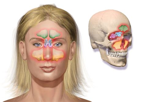 Sinonasal Tumor: Symptoms, Anatomy, Diagnosis and Treatment - Houston ...