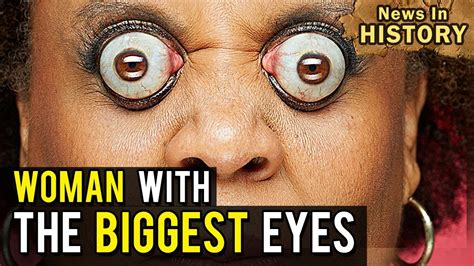 The Biggest Eyes in the World: Kim Goodman - News In History - YouTube