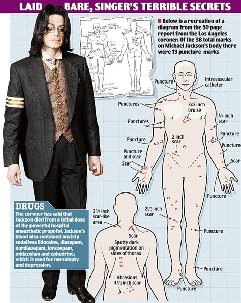 Michael Jackson: Post mortem reveals 13 puncture marks on his body ...