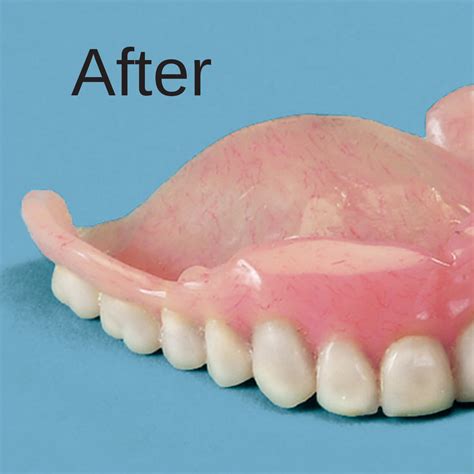 Home Denture Repair Kit