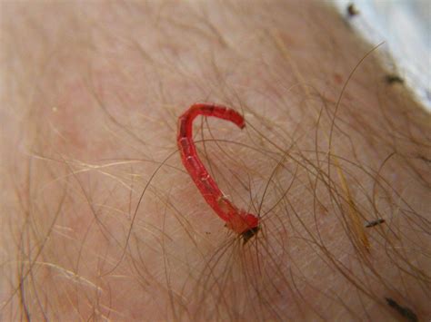 Red worms crawling out of my skin after a session. | General Discussion Forums, page 1