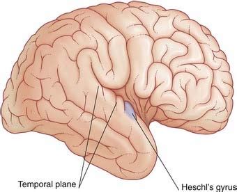 Cochlear nerve | Neupsy Key