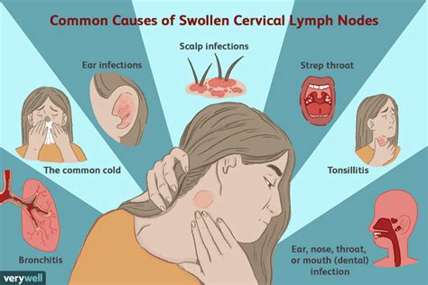 Enlarged Cervical Lymph Nodes