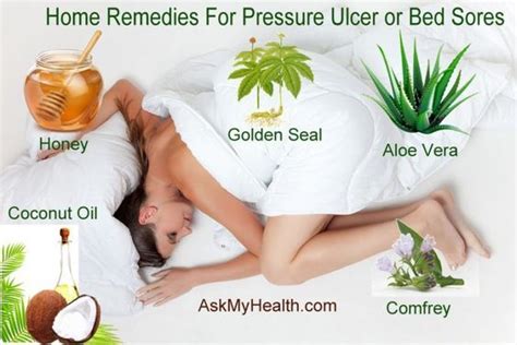 5 Best Home Remedies for Pressure Sores (Bed Sores or Pressure Ulcers) | Bed sores, Home ...