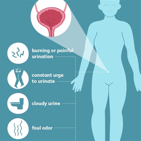 Urinary Tract Infection - Visit MedCare Urgent Care
