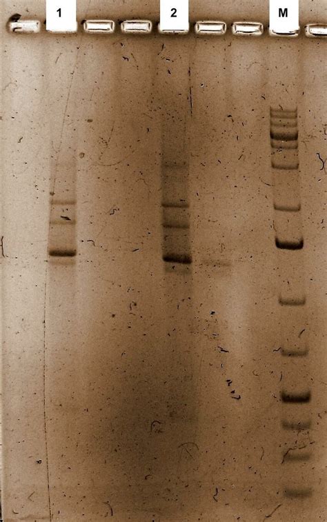 Electrophoregrams of products of amplification of DNA samples of... | Download Scientific Diagram