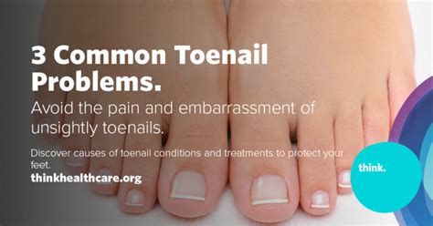 3 Common Toenail Problems - Think Whole Person Healthcare