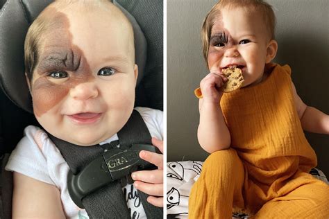 Mom Shares Her Daughter’s Unique Birthmark, Gathering 300k Followers Supporting Their Journey ...