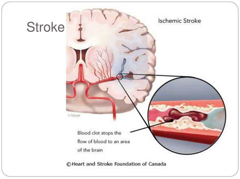 PPT - Sugar Related Diseases PowerPoint Presentation, free download ...