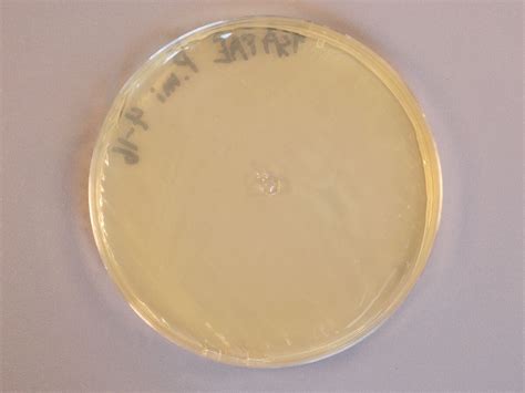 Proteus | Classroom Bacterial Identification Wiki | Fandom