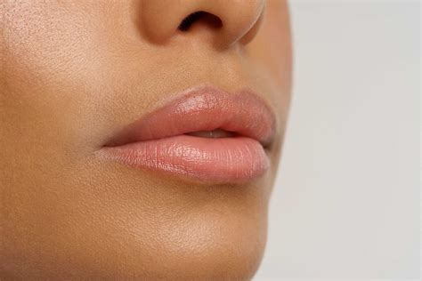 Botox Lip Flip How Long to See Results? | Michelle Esthetics