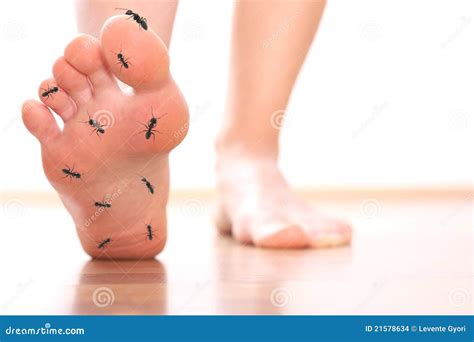 Foot Stepping Ant Chicle Diabetes Leg Stock Photo | CartoonDealer.com #21578634