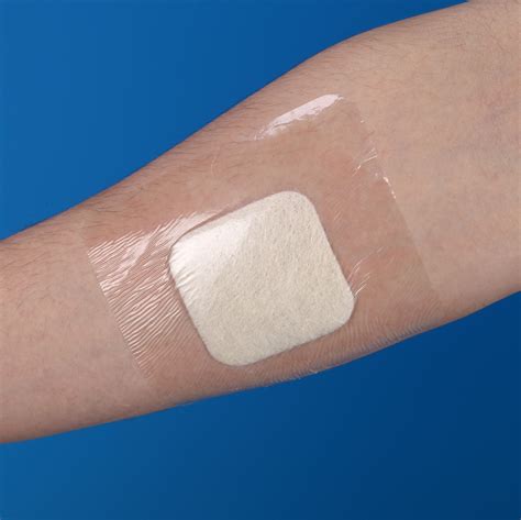 Surgical Wound Dressing Types at Thomas Mauro blog