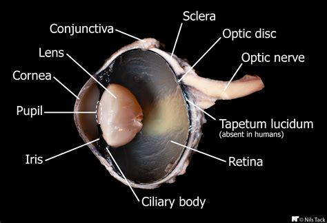 Cow eye - internal anatomy | Cow eyes, Medical anatomy, Medical memes