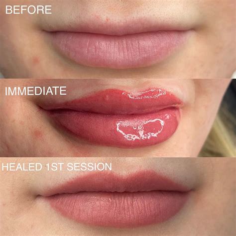 Permanent Makeup Full Lips Before And After | Saubhaya Makeup