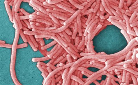 Legionella Detected in NYC Police Station, Las Vegas Resort - Infectious Disease Advisor