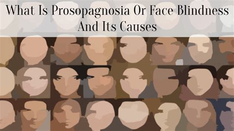 What Is Prosopagnosia Or Face Blindness And Its Causes - SuccessYeti