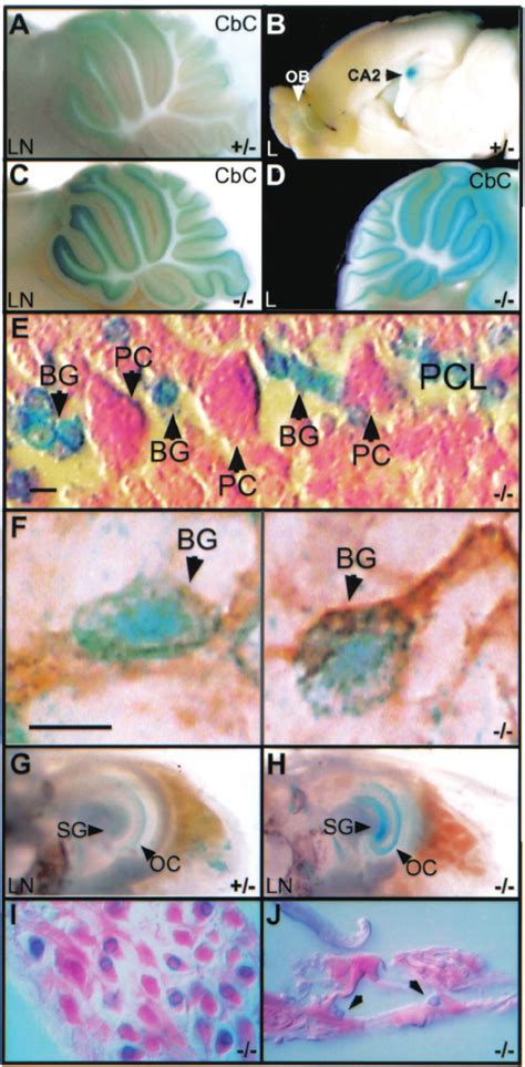 X-Gal staining of adult tissues showing that punc is ex- pressed in the... | Download Scientific ...