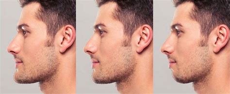 Male Facelift Surgery | The Georgia Center for Facial Plastic Surgery