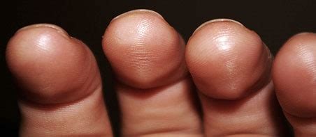 Best Way to Build Calluses for Guitar - TheGuitarLesson.com