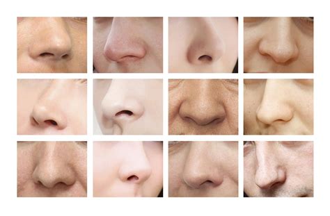 14 different nose shapes - camukraine