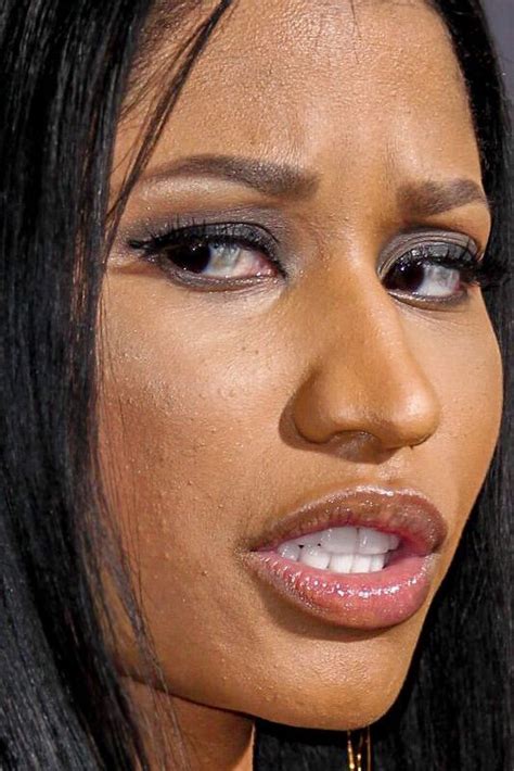 Nicki Minaj Without Teeth