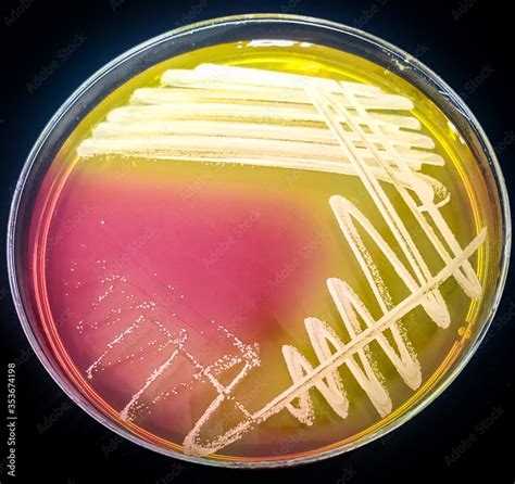 staphylococcus aureus growth on Mannitol salt agar 24h, incubate at 37 ...