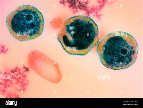 Chlamydia pneumoniae bacteria. Coloured transmission electron ...