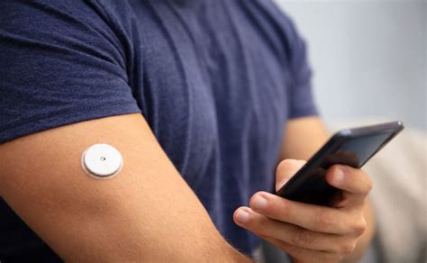 DexCom launches connected CGM system with new AID feature